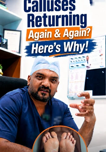 Hospital reel: Why calluses keep coming back, 15.3K views